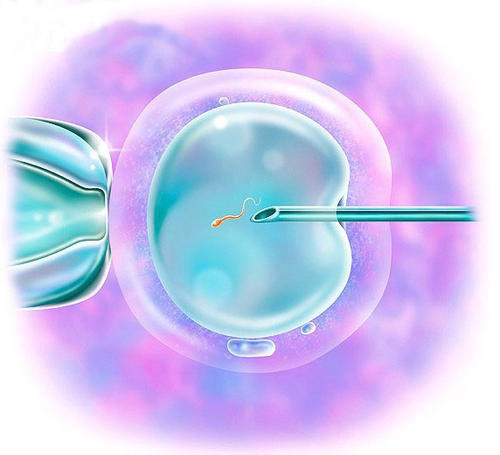 卵泡发育不良能否做试管婴儿（图1）